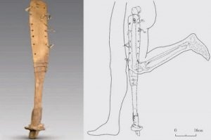 Археологи знайшли протез віком 2200 років
