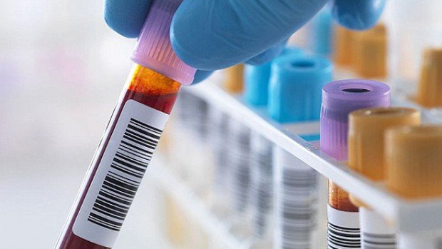 «Умный» анализ крови может революционизировать лечение рака