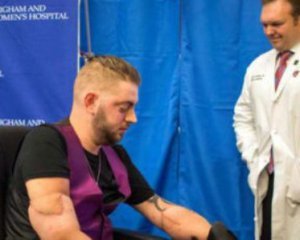 Американець Джон Пек, який втратив обидві руки, погодився на складну експериментальну операцію по пересадці рук у Бостоні