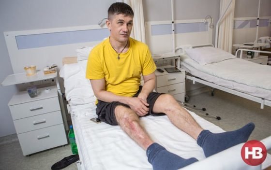 С помощью стволовых клеток врачи сумели спасти ногу украинскому бойцу Александру Бабулю