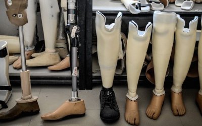 Уряд прийняв рішення щодо зменшення фіскального навантаження на державні підприємства протезно-ортопедичної сфери