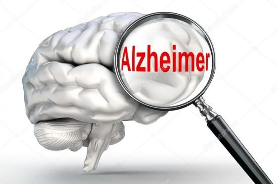 Медики назвали одну з головних причин виникнення хвороби Альцгеймера