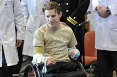 В США солдату-инвалиду сделали двойную пересадку рук