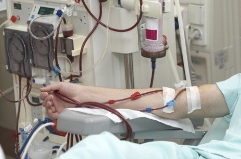 Заява МОЗ України щодо ситуації із забезпеченням пацієнтів гемодіалізом у м. Київ