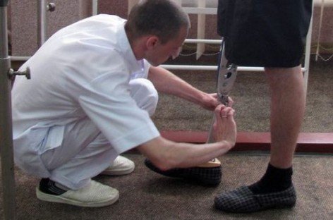 На Житомирському протезно-ортопедичному підприємстві протезують бійців АТО