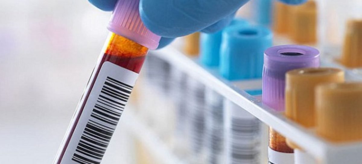 «Умный» анализ крови может революционизировать лечение рака