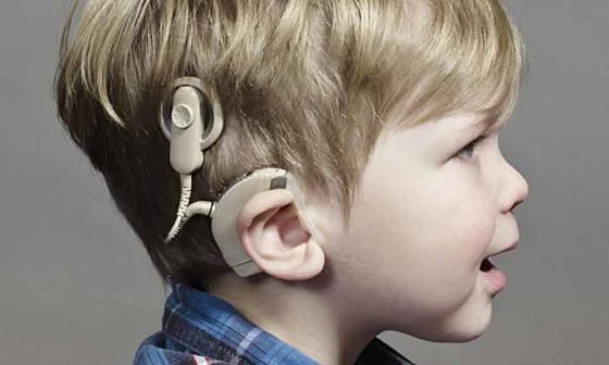 Розпочалось проведення операцій дітям з порушенням слуху, які зареєстровані у черзі на кохлеарну імплантацію