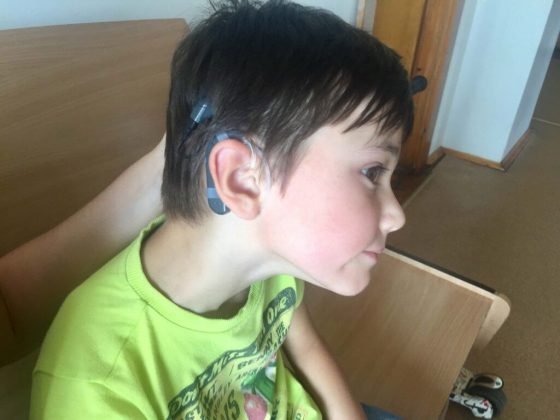 Державний Центр реабілітації дітей з порушенням слуху та мовлення: Перейняли теорію, запроваджують практику