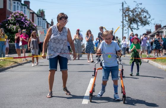 9-річний Тобіас має церебральний параліч і аутизм. За 70 днів він сам із ходулями пройшов цілий марафон
