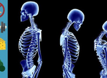 20 жовтня 2021 року – Всесвітній день профілактики остеопорозу