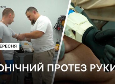 “Треба жити далі”: історія українського воїна Михайла Юрчука, якому встановили біонічний протез (ФОТО, ВІДЕО)