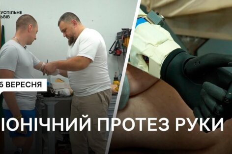 “Треба жити далі”: історія українського воїна Михайла Юрчука, якому встановили біонічний протез (ФОТО, ВІДЕО)
