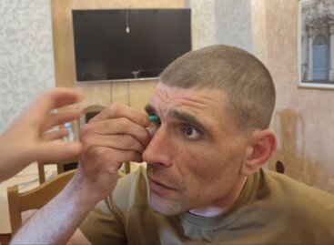 Безкоштовне протезування очей для ветеранів табору «Життя після війни»